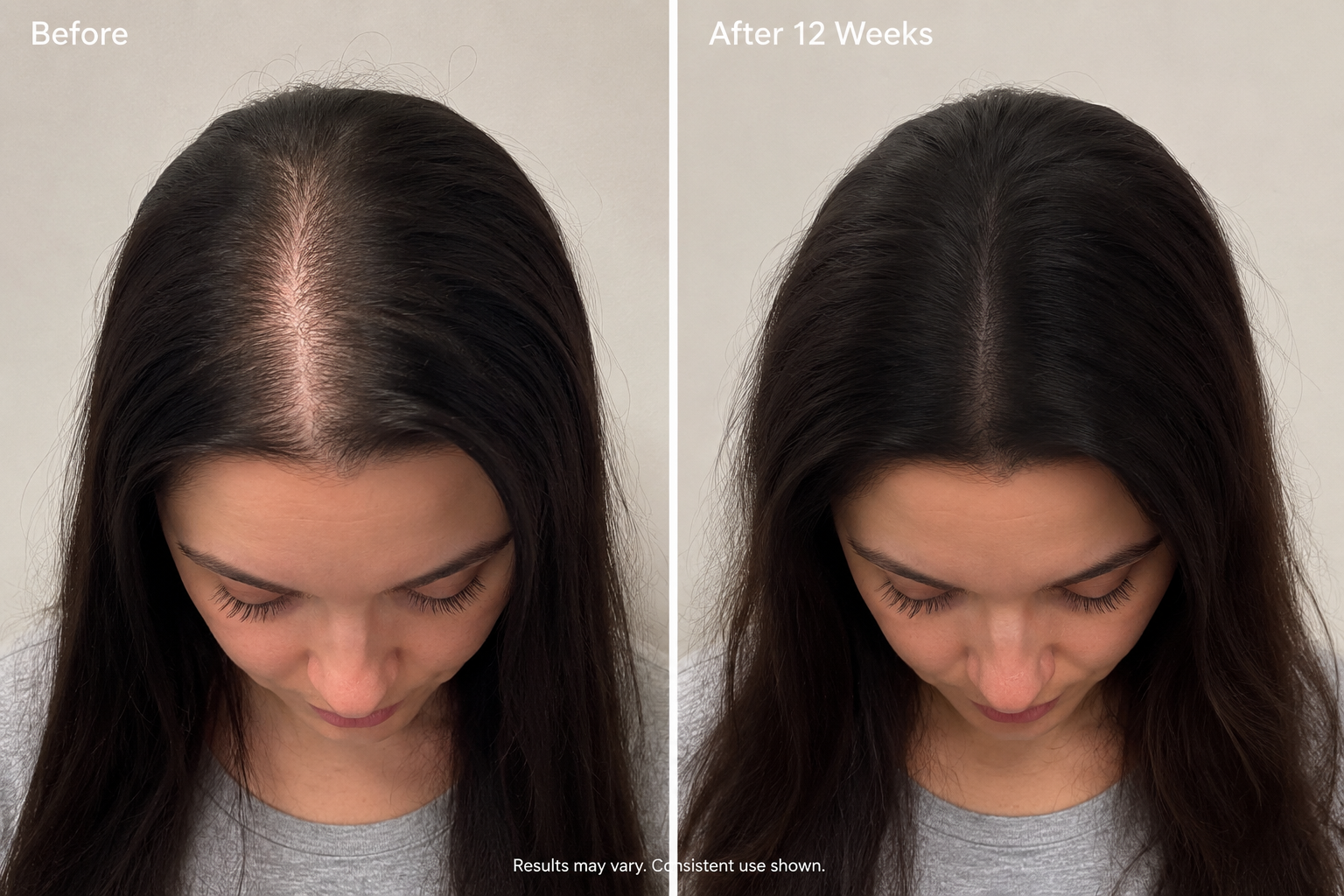 Multi-Peptide Hair Density Serum